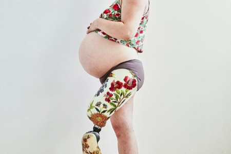 Женщина без ноги вдохновляет будущих мам по всему миру