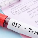 Новое исследование доказало неточность тестов на ВИЧ