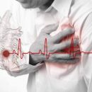 Названы самые первые симптомы приближающегося инфаркта