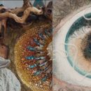 Мужчина с червями в глазах смог превратить болезнь в искусство