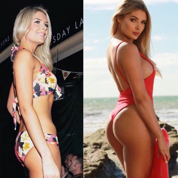 Звезда Playboy показала фото до и после операции Звезда Playboy показала фото до и после операции