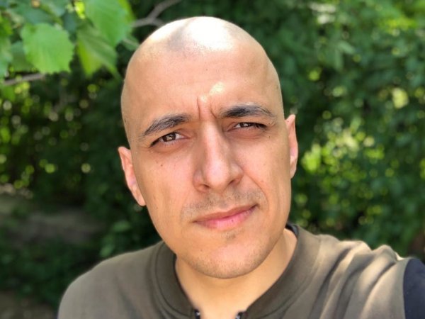 Попал в мир «безресничия»: Больной раком Эд Мацаберидзе рассказал о последствиях химиотерапии Попал в мир «безресничия»: Больной раком Эд Мацаберидзе рассказал о последствиях химиотерапии